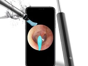 Otoscope d'endoscope de retrait de cérumen