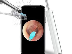 Otoscope d'endoscope de retrait de cérumen