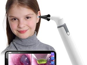 Caméra d'oreille Otoscope sans fil avec double